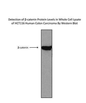 CTNNB1 Rabbit Polyclonal Antibody