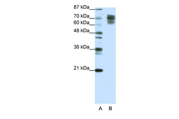 CTNNB1 Rabbit Polyclonal Antibody