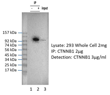 CTNNB1 Rabbit Polyclonal Antibody