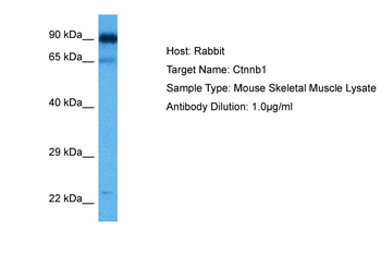 CTNNB1 Rabbit Polyclonal Antibody