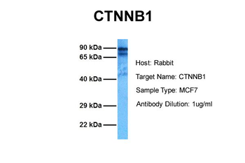 CTNNB1 Rabbit Polyclonal Antibody