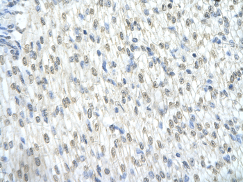 CTNNB1 Rabbit Polyclonal Antibody