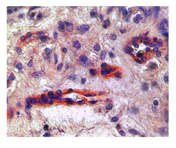KDR Rabbit Polyclonal Antibody