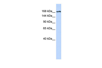 KDR Rabbit Polyclonal Antibody