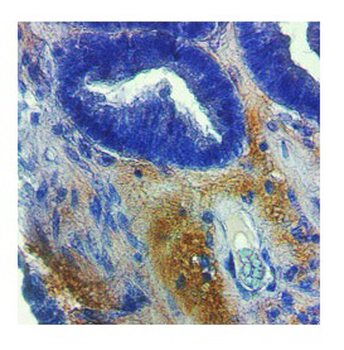 MMP2 Rabbit Polyclonal Antibody