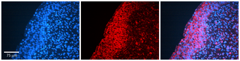 MMP2 Rabbit Polyclonal Antibody