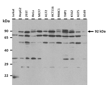 PRDM1 Rabbit Polyclonal Antibody