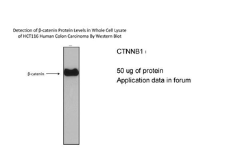 CTNNB1 Rabbit Polyclonal Antibody