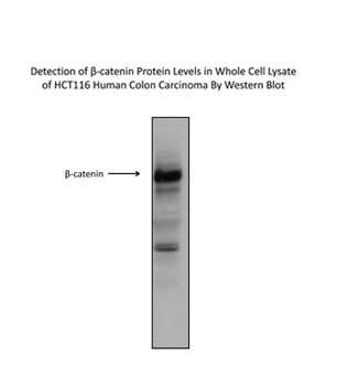 CTNNB1 Rabbit Polyclonal Antibody