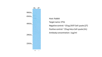 ETS1 Rabbit Polyclonal Antibody