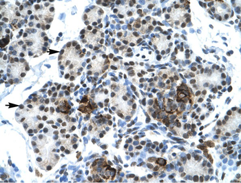 ETS1 Rabbit Polyclonal Antibody
