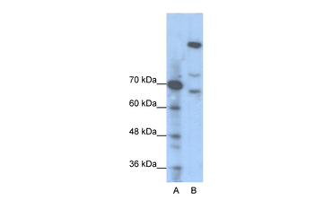 GLI1 Rabbit Polyclonal Antibody