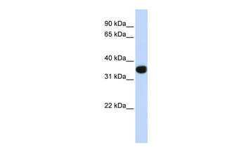 TLX1 Rabbit Polyclonal Antibody