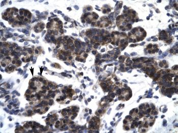 SMAD3 Rabbit Polyclonal Antibody