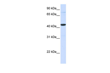 FOS Rabbit Polyclonal Antibody