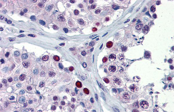 NFX1 Rabbit Polyclonal Antibody