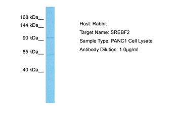 SREBF2 Rabbit Polyclonal Antibody