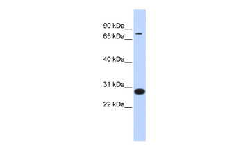 TCF12 Rabbit Polyclonal Antibody