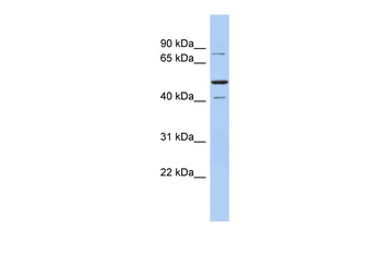 SSRP1 Rabbit Polyclonal Antibody