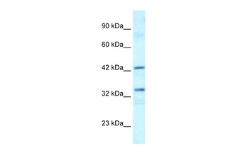 TAF1A Rabbit Polyclonal Antibody
