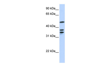 ETV6 Rabbit Polyclonal Antibody