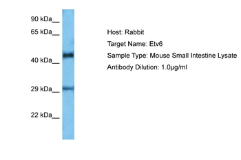 ETV6 Rabbit Polyclonal Antibody