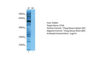 ETV6 Rabbit Polyclonal Antibody