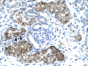 GTF2H1 Rabbit Polyclonal Antibody