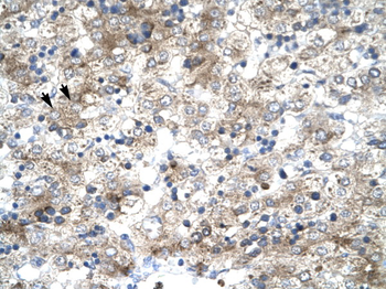 GTF2H1 Rabbit Polyclonal Antibody