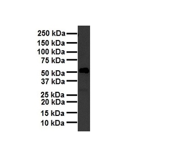 NR2F2 Rabbit Polyclonal Antibody