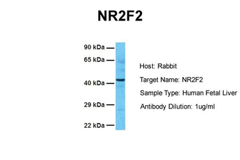 NR2F2 Rabbit Polyclonal Antibody