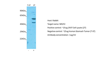 NR2F2 Rabbit Polyclonal Antibody