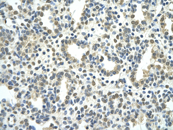 NR2F2 Rabbit Polyclonal Antibody