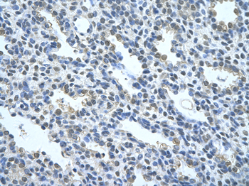 NR2F2 Rabbit Polyclonal Antibody