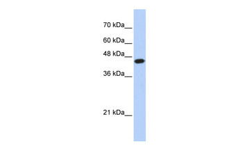 E2F1 Rabbit Polyclonal Antibody