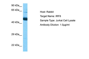 IRF8 Rabbit Polyclonal Antibody
