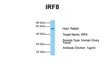 IRF8 Rabbit Polyclonal Antibody