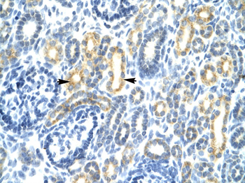 IRF8 Rabbit Polyclonal Antibody