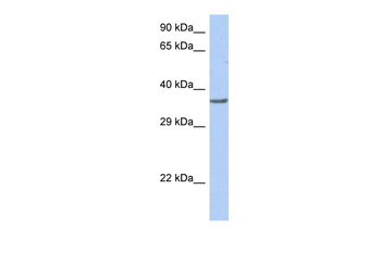 TFDP1 Rabbit Polyclonal Antibody