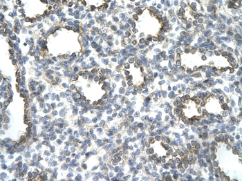 JUN Rabbit Polyclonal Antibody