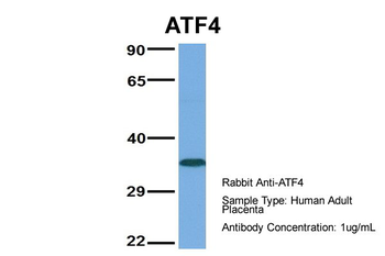 ATF4 Rabbit Polyclonal Antibody