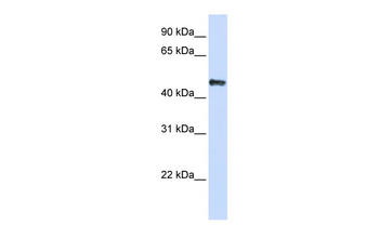 CSDA Rabbit Polyclonal Antibody