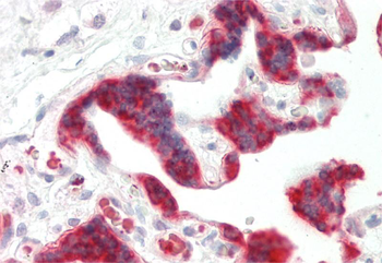 ID1 Rabbit Polyclonal Antibody