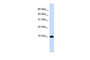 ID1 Rabbit Polyclonal Antibody