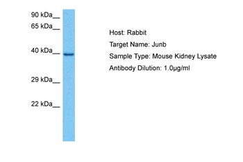 JUNB Rabbit Polyclonal Antibody