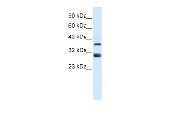 TAL1 Rabbit Polyclonal Antibody