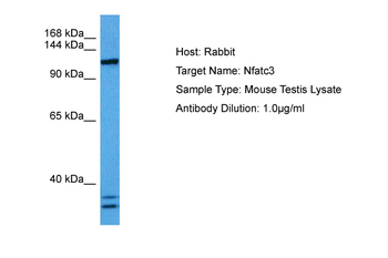 NFATC3 Rabbit Polyclonal Antibody