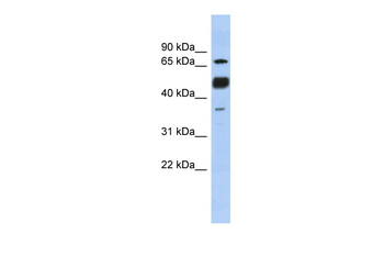 NFATC1 Rabbit Polyclonal Antibody