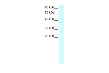 GTF2B Rabbit Polyclonal Antibody
