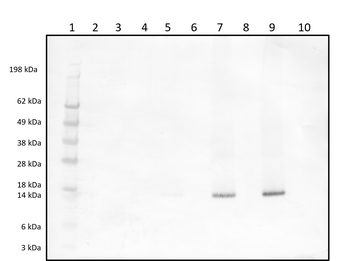 Rabbit polyclonal antibodies to human IFN-gamma